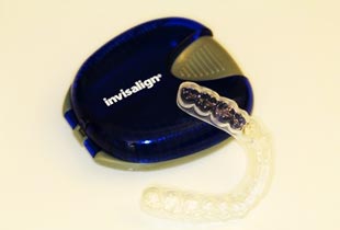 Invisalign®